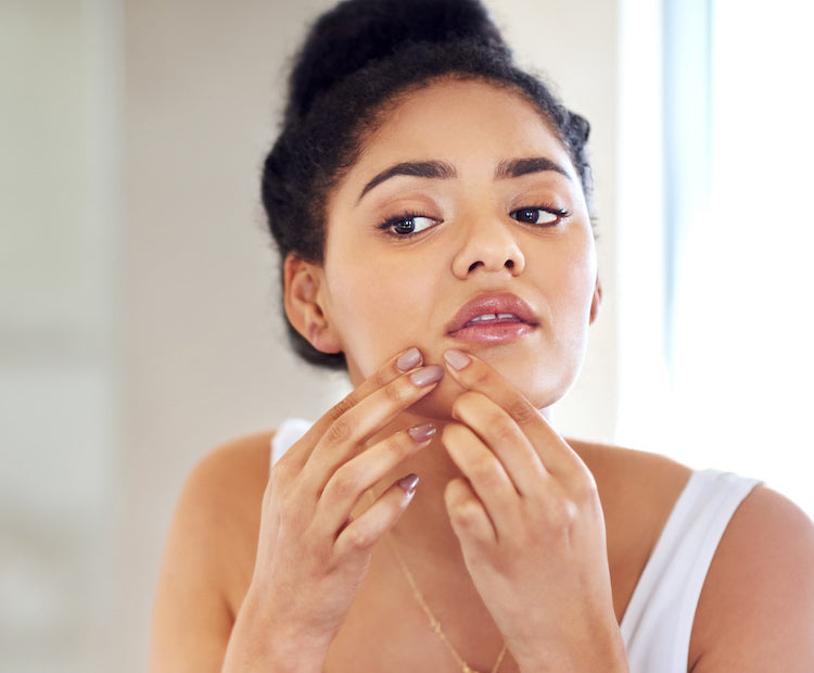 Preventing Acne With Diet?