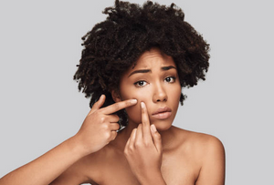 Have a Case of the Same Pimple? Here’s Why