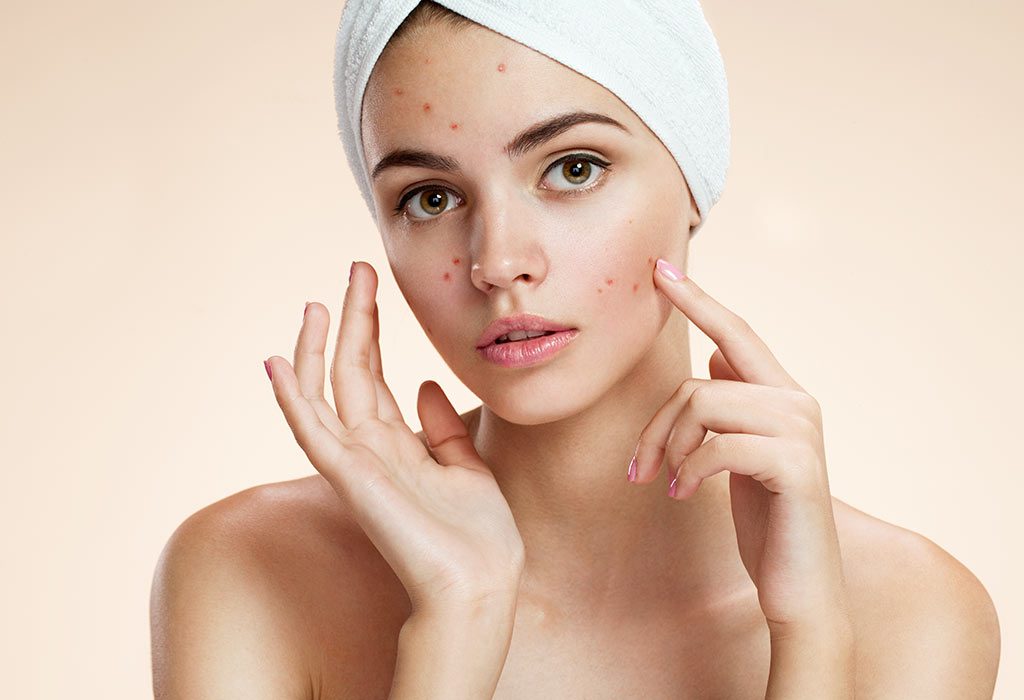 F is for Failure: Past Acne Treatments