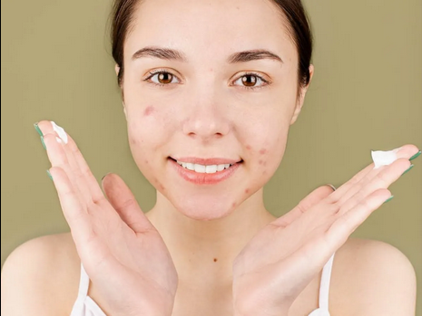 The Top 3 Causes of Period-Related Breakouts—and What You Can Do About Them