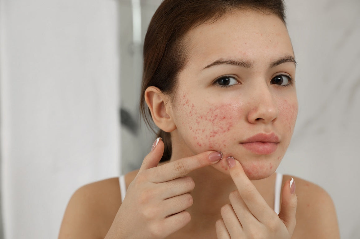 Balancing & Clear Skin Essentials