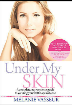 Under My Skin eBook